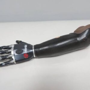OSSUR  Touch i-Limb Bionic AE Hand Prosthesis
