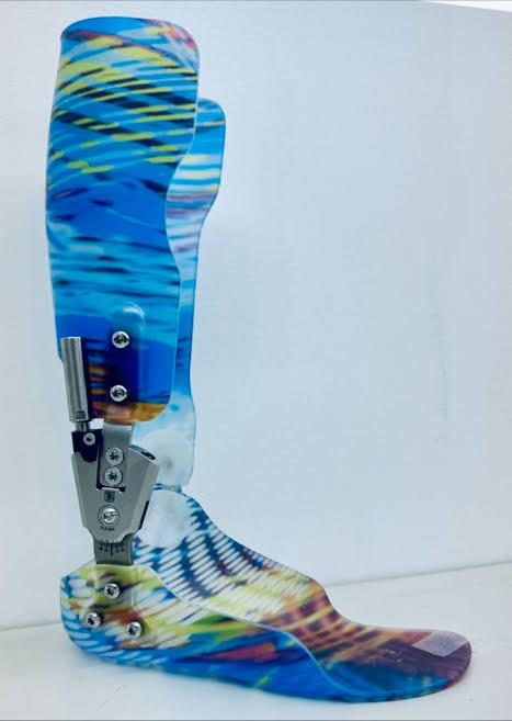 Becker AFO with Ankle Movement