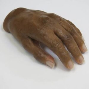 Regal Prosthesis   Custmade Partial hand Prosthesis