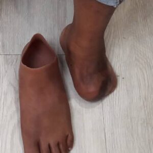 Regal Prosthesis    Custmade Silicone Partial Foot Prosthesis