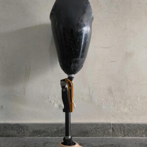 Above knee Prosthesis